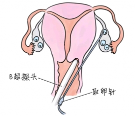 幼儿学画画，太原捐卵宝宝学画画，学画画的好处，如何学画画
