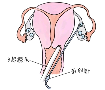 幼儿学画画，太原捐卵宝宝学画画，学画画的好处，如何学画画